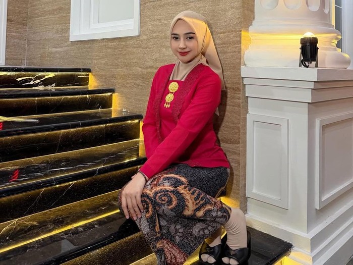Ria Ricis alasan operasi hidung.