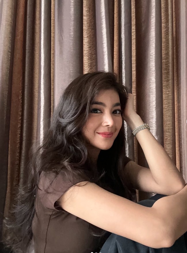 Potret Wajah Baru Artis Usai Oplas Hidung, Terbaru Ria Ricis