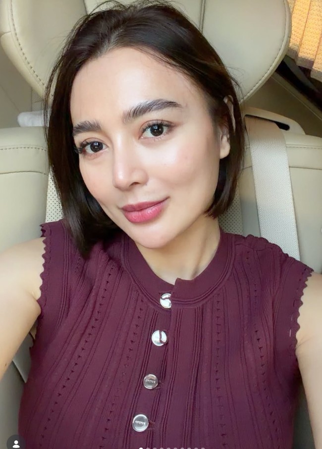 Potret Wajah Baru Artis Usai Oplas Hidung, Terbaru Ria Ricis