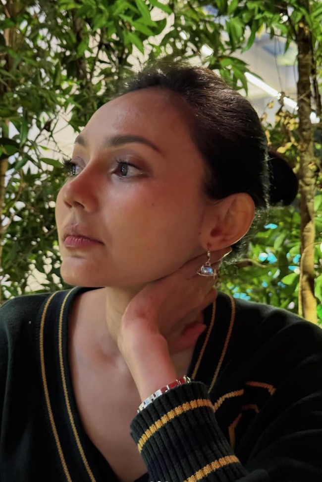 Potret Wajah Baru Artis Usai Oplas Hidung, Terbaru Ria Ricis