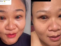 Viral Mata Ibu Memerah Usai Melahirkan, Obgyn Bagikan Cara Mengejan yang Aman