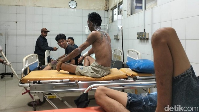 Korban penyiraman air keras saat dirawat di RSUD dr Soekardjo Tasikmalaya.