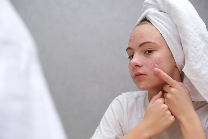 Obat Jerawat Tretinoin
