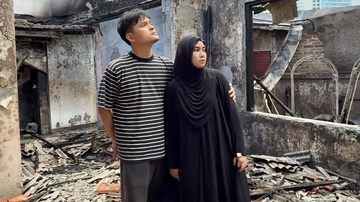 Kondisi Terkini Anisa Rahma Usai Musibah Rumah Terbakar