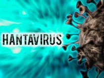 Video Kondisi Terkini WNA Kontak Erat Hantavirus Klaster MV Hondius