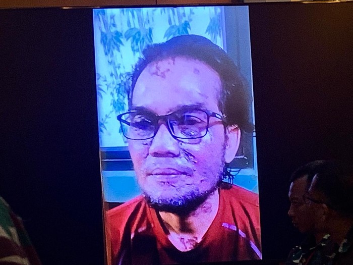 Oditur tampilkan barang bukti kasus penyiraman air keras terhadap Andrie Yunus (detikcom)