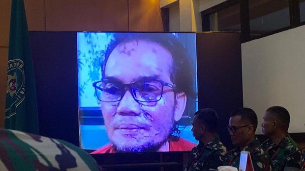 Oditur tampilkan foto wajah terdakwa yang terluka akibat cipratan air keras saat siram Andrie Yunus (detikcom)