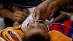 Wabah Campak di Dhaka, Anak-Anak Jalani Perawatan Intensif