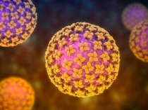 1 Kasus Suspek Hantavirus di Kulon Progo Dinyatakan Negatif