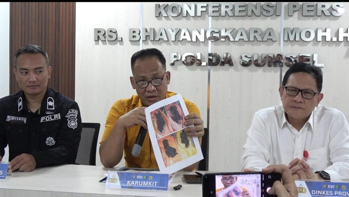 Karumkit RS Bhayangkara beberkan penemuan satu kantong jenazah dua bagian tubuh