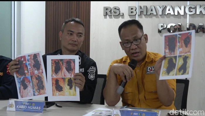 Karumkit RS Bhayangkara dr Budi Susanto saat menjelaskan penemuan dua jenazah dalam satu kantong jenazah yang menempel dengan ketiak yang diduga anak-anak.