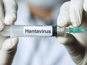 Dinkes DKI Temukan 4 Kasus Hantavirus di Jakarta: 3 Sembuh, 1 Masih Suspek