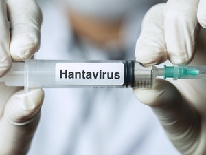 Kemenkes: Kontak Erat Hantavirus MV Hondius di DKI Sehat, Masih Isolasi Sampai Juni