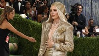 Viral Model Berkaki Emas di Met Gala, Kakinya Diamputasi karena Tampon