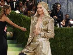 Viral Model Berkaki Emas di Met Gala, Kakinya Diamputasi karena Tampon