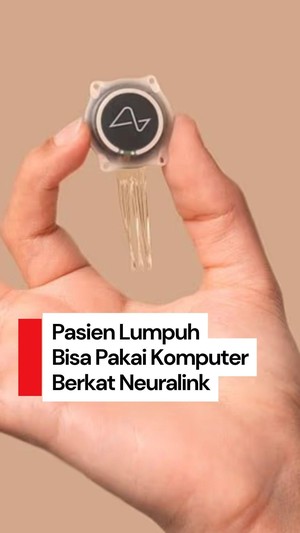 Video: Cip Otak Neuralink Memungkinkan Pasien Lumpuh Menggunakan Komputer