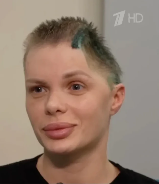 Model asal Rusia, Anzhelika Tartanova, masih berjuang memulihkan diri setelah mengalami penganiayaan brutal dari kekasihnya sendiri hingga sebagian tengkoraknya harus diangkat demi menyelamatkan nyawa. Wanita 33 tahun itu mengalami cedera kepala parah, kerusakan otak serius, hingga gangguan bicara dan daya ingat setelah diserang oleh pengusaha konstruksi, Dmitry Kuzmin, pada November 2025 lalu.  Foto: dok. Instagram