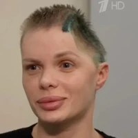 Model asal Rusia, Anzhelika Tartanova, masih berjuang memulihkan diri setelah mengalami penganiayaan brutal dari kekasihnya sendiri hingga sebagian tengkoraknya harus diangkat demi menyelamatkan nyawa. Wanita 33 tahun itu mengalami cedera kepala parah, kerusakan otak serius, hingga gangguan bicara dan daya ingat setelah diserang oleh pengusaha konstruksi, Dmitry Kuzmin, pada November 2025 lalu.  Foto: dok. Instagram