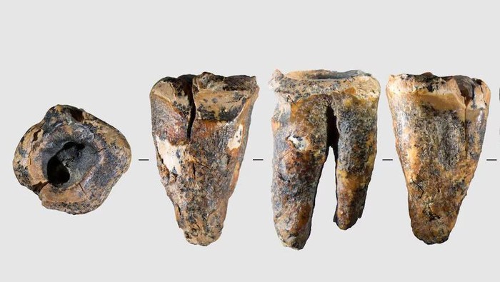 bukti praktik perawatan gigi tertua yang diketahui saat ini, dilakukan neanderthal