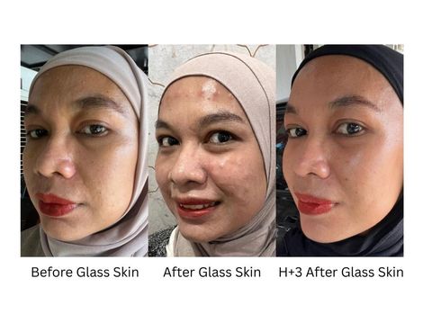 Glass Skin Treatment