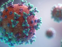 Virus Ebola Belum Terdeteksi di Indonesia, Pemerintah Tetap Waspada