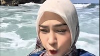 Sebelumnya Ria Ricis memang terlihat beda. Ia mengaku memang sudah melakukan operasi di bagian hidungnya. Foto: dok TikTok Ria Ricis