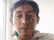 Pria Surabaya Jadi Korban Kekerasan Debt Collector, Wajah Disiram Kopi