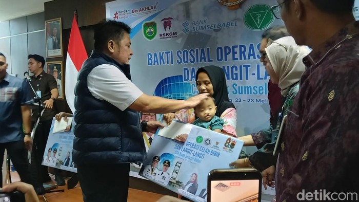 Gubernur Sumsel Herman Deru berikan bantuan untuk pasien bibir sumbing.