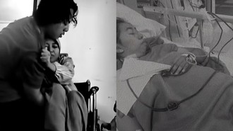 Viral Kisah Perempuan Bekasi Idap Tuberkulosis Tulang hingga Tak Bisa Berjalan