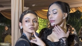 Denada dan Rina Nose Pamer Hidung Baru di Pernikahan Anak Soimah