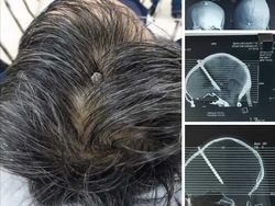 Foto-foto Ini Terlihat Normal, Sampai Detailnya Bikin Merinding