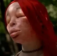 Nekat Suntik Silikon Sendiri, Wajah Wanita Ini Berubah Hingga Sulit Dikenali