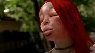Nekat Suntik Silikon Sendiri, Wajah Wanita Ini Berubah Hingga Sulit Dikenali
