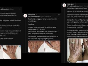 Wanita 52 Tahun Kena Kanker gegara Sering Manicure UV Nail Lamp, Benarkah?