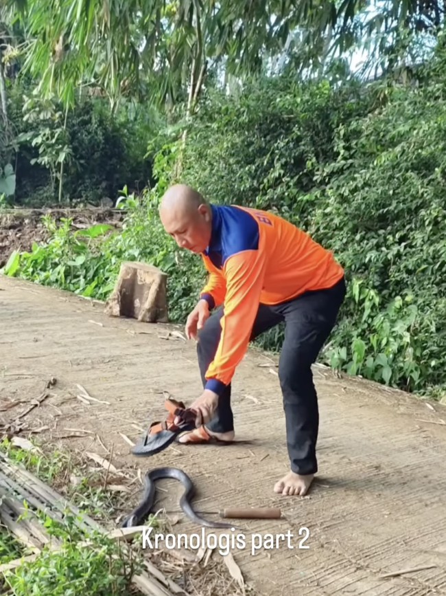 Mata Heru Jejak Si Gundul Kena Sembur Bisa Ular Kobra, Begini Kondisinya