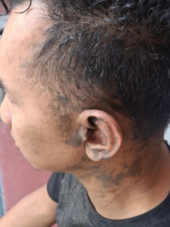Kondisi korban setelah dianiaya dan dicelupkan ke parit.