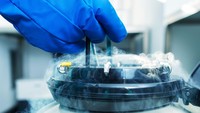 Banyak Selebriti Jalani Egg Freezing, Berapa Usia Ideal Wanita Bekukan Sel Telur?