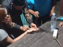 Paniknya Remaja Banyuwangi Datangi Damkar gegara Jarinya Bengkak