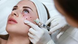Ingin Hasil Skin Booster Maksimal? Ini Urutan Perawatan yang Wajib Diikuti