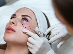 Tren Perawatan Skin Booster Bikin Wajah Glowing, Ini Manfaat dan Harganya