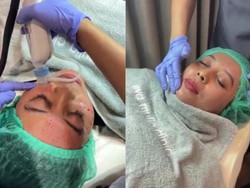 Video: Semua yang Perlu Kamu Tahu soal Skin Booster Alias Tren 'Bentol Sultan'