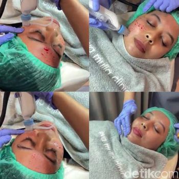 Tindakan perawatan skin booster. Tindakan perawatan skin booster.