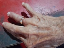 Pakai Cincin Kekecilan demi Hadiri Pesta, Nenek di Jogja Sambat ke Damkar