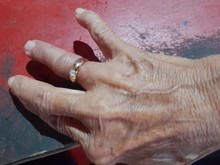 Pakai Cincin Kekecilan demi Hadiri Pesta, Nenek di Jogja Sambat ke Damkar