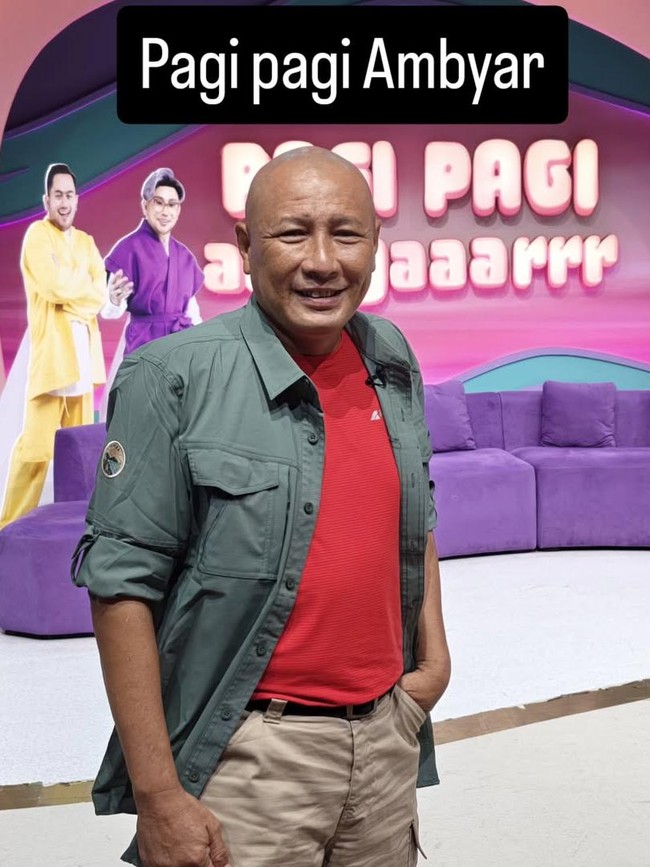 Kondisi Mata Heru Gundul Usai Tersembur Bisa Ular Kobra