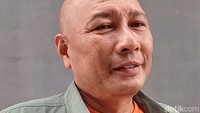 Mata Heru Gundul tersembur bisa ular kobra saat melakukan aksi penyelamatan. Kini ia terlihat sudah bisa membuka matanya lebar-lebar. (Foto: Febryantino Nur Pratama)