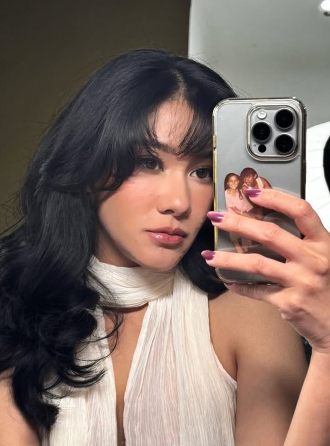 Selain face lift, Naysilla juga melakukan fat graft untuk membuat penampilannya jadi lebih segar. Adik Nana Mirdad itu pun kini terlihat jadi semakin cantik. Foto: Instagram/@naymirdad