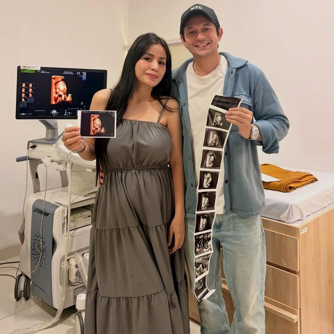 Selamat! Andrew Andika Mau Punya Anak dari Violentina Kaif
