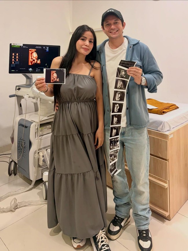 Selamat! Andrew Andika Mau Punya Anak dari Violentina Kaif