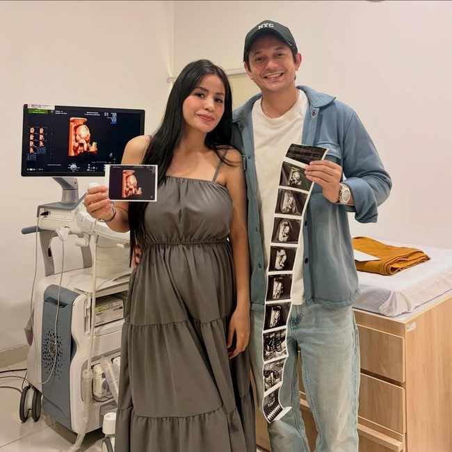 Momen Andrew Andika Girang Akan Dikaruniai Anak Perempuan